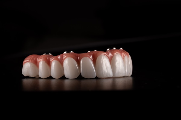 Benefits Of Dentures With All On   Implants