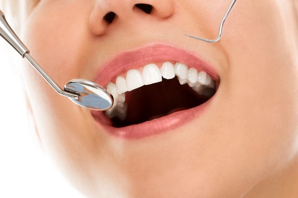 Are There Different Types Of Dental Cleanings?
