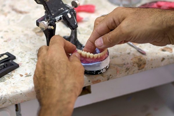 An A To Z Guide To Full Mouth Reconstruction