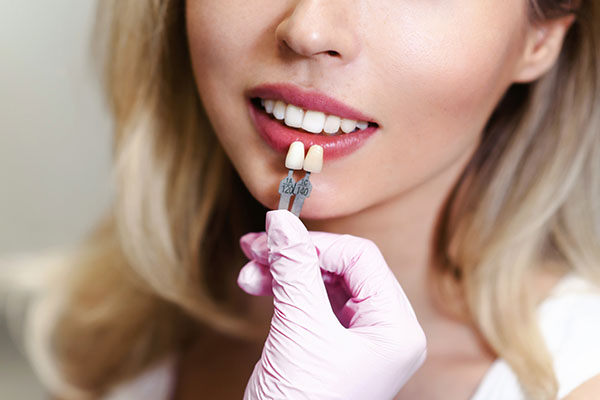 How Effective Are Dental Veneers? from Total Care Implant Dentistry in Palm Desert, CA