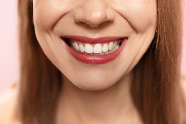Benefits Of Implant Supported Dentures