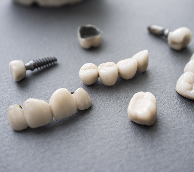 Palm Desert The Difference Between Dental Implants and Mini Dental Implants