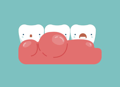 By Providing Periodontics In Palm Desert, We Can Improve Your Gum Health